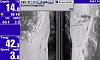 Click image for larger version.&nbsp;

Name:	Under bridge.jpg&nbsp;
Views:	669&nbsp;
Size:	162.5 KB&nbsp;
ID:	15896